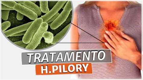 Tratamento Caseiro Para Bact Ria Helicobacter Pylori Alimentos Que