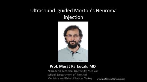 Ultrasound Guided Morton S Neuroma Injection Youtube