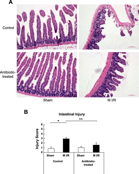 Depletion Of Gut Commensal Bacteria Attenuated Intestinal Injury