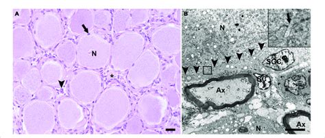 Hematoxylin And Eosin Hande Stained Section A And Transmission