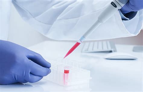 How to Count Cells: An Overview of Cell Counting Methods I Logos Biosystems