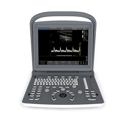 Buy Ultrasound Machine