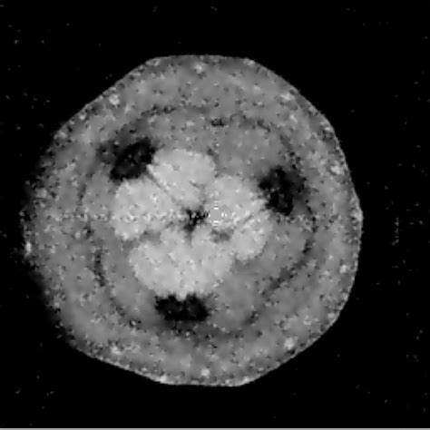 Result Of The Adaptive Anisotropic Diffusion Filter Incorporating The