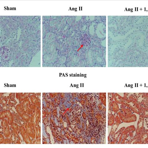 D Inhibited Renal Fibrosis In The Ang Ii Infused Mice