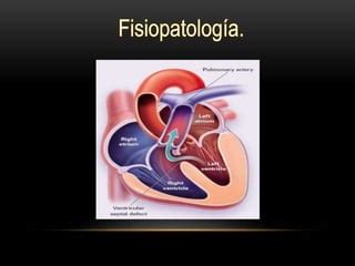 Cardiopatia PPT