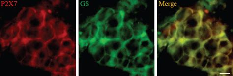 The Double Label Immunofluorescence Staining Of P2X7 And GS In SCG The