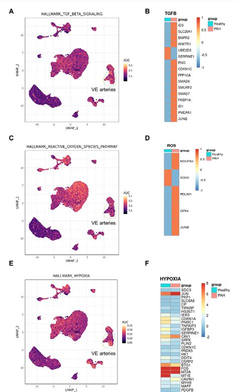 Figure From Identi Cation Of Potential Biomarkers For Idiopathic