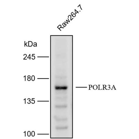 Solarbio K112180P Anti POLR3A Polyclonal Antibody 试剂仪器耗材