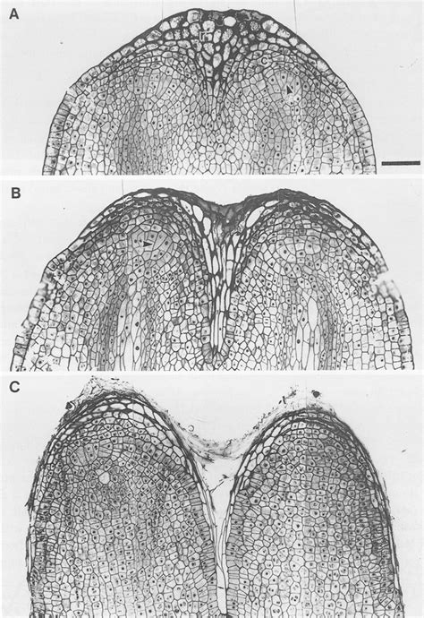 Longisections Of Root Apices A Root Primordia Covered By Rhizophore