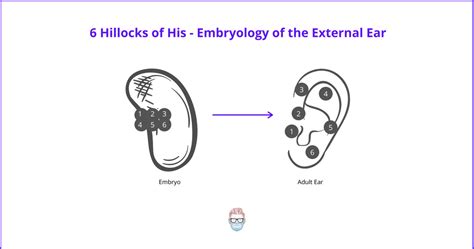 Microtia Causes Classifications Surgery