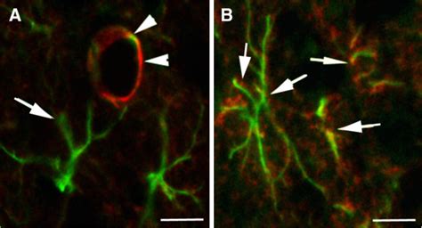 AQP4 Distribution In The Astrocyte In Normal Cortex And After Brain