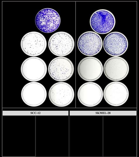 The potent phenolic compounds 11 and 13 significantly inhibit colony ...