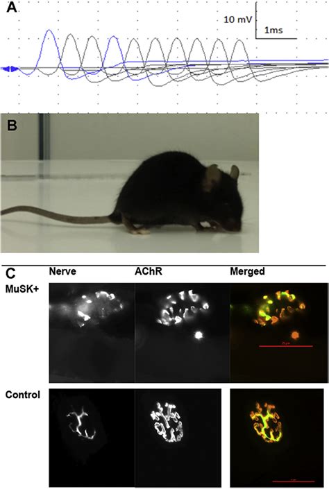 Cognitive Dysfunction In Mice With Passively Induced Musk Antibody