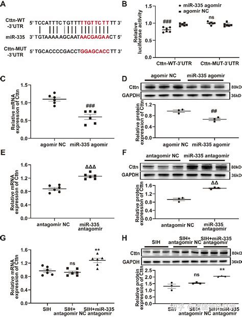 CNSNT上海大学杜东书团队发现延髓头端腹外侧区lncRNA INPP5F通过miR 335 Cttn轴调控应激性高血压机制 知乎