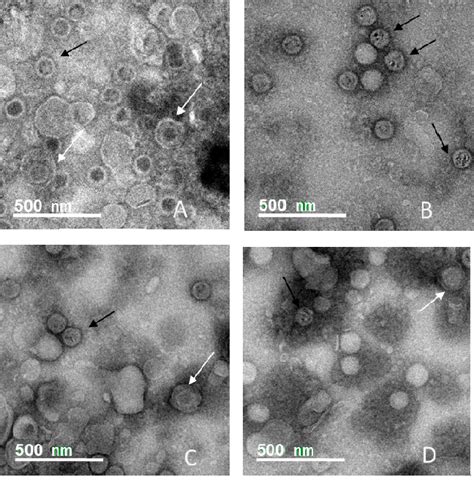 Electron Micrograph Images Of Hsv Virions Treated With Different