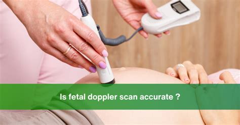 Is Fetal Doppler Scan Accurate