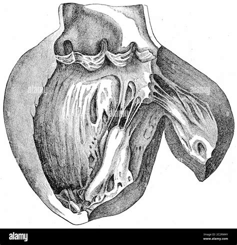 Heart With Left Ventricle Laid Open Showing The Aortic Cusps And The