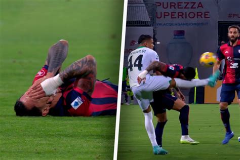 Gianluca Lapadula recibió tremendo golpe en el rostro durante Cagliari