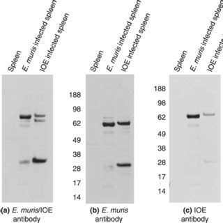 Western Blot Of One Dimensional Gel Electrophoresis Probed With