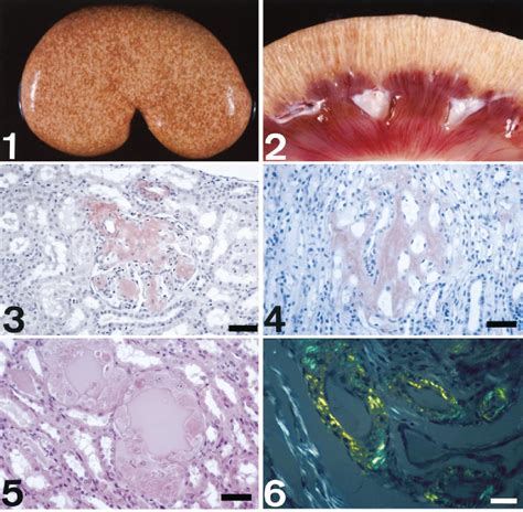 Pathology Of Aa Amyloidosis In Domestic Sheep And Goats Semantic Scholar