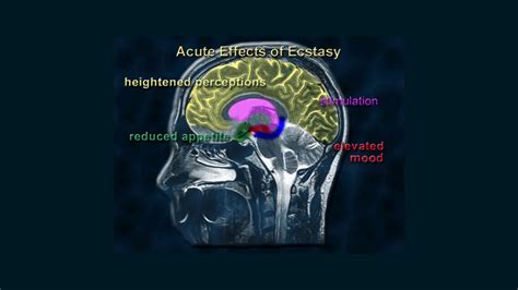 Effects Of Ecstasy On The Brain