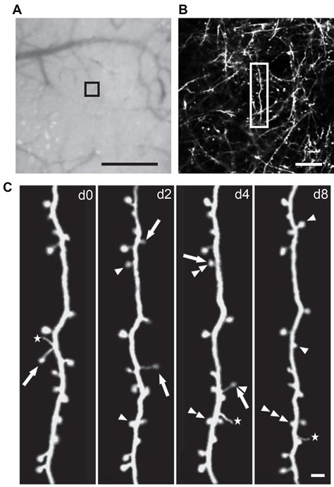 Two Photon In Vivo Imaging Of Dendritic Spines In The Mouse Cortex