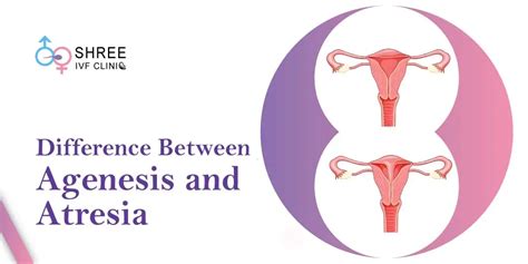 Atresia Of Vagina Causes Symptoms Diagnosis And Treatment