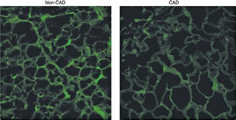 Figure From Adipose Tissue Derived Omentin Function And Regulation