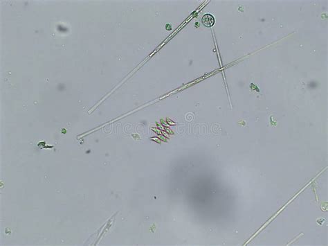 Microalgae Under Microscopic View Green Algae Cyanobacteria