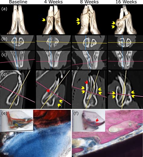 Computed Tomography Ct Scans And D Reconstruction For The Developed