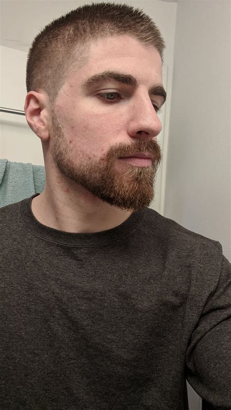 Months In Keep Going Or Rock A Goatee With Short Sides Like I Used