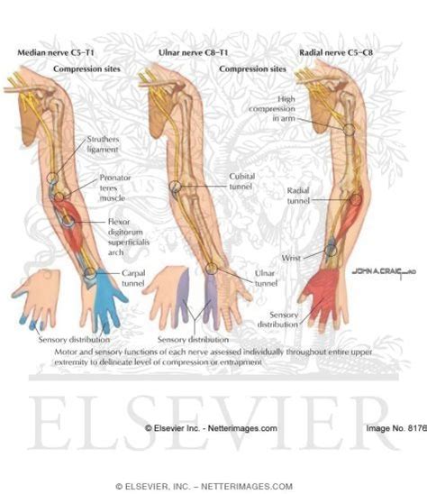 Nerve Compression Syndromes Entrapment Neuropathies Nerve Entrapments