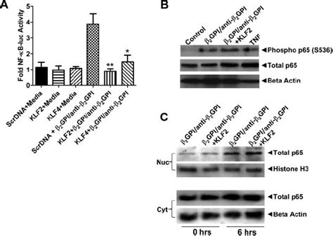 Expression Of Klf Or Klf Inhibits Nf B Transcriptional Activity In