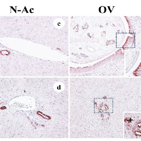 Representative The Expression Of PCNA In The Liver Tissue Of The