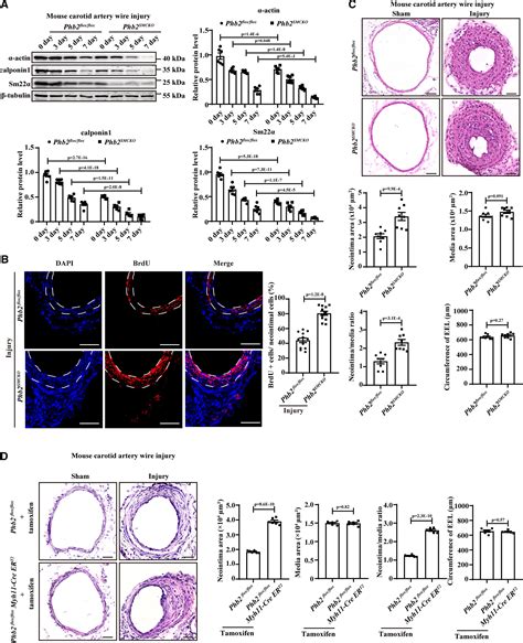 PHB2 Maintains The Contractile Phenotype Of VSMCs By Counteracting PKM2