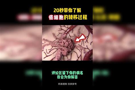 20秒带你了解癌细胞转移过程癌细胞过程