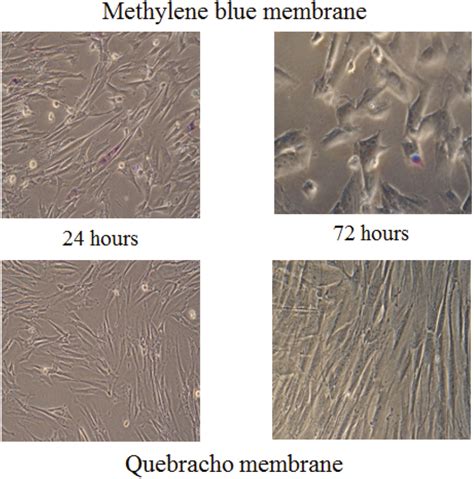 5 Microscopic Analysis Of Human Dermal Fibroblast Culture Samples Sowed