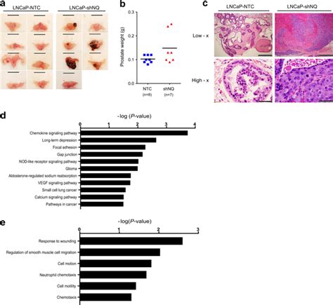 Attenuation Of Nad P Hquinone Oxidoreductase 1 Aggravates Prostate