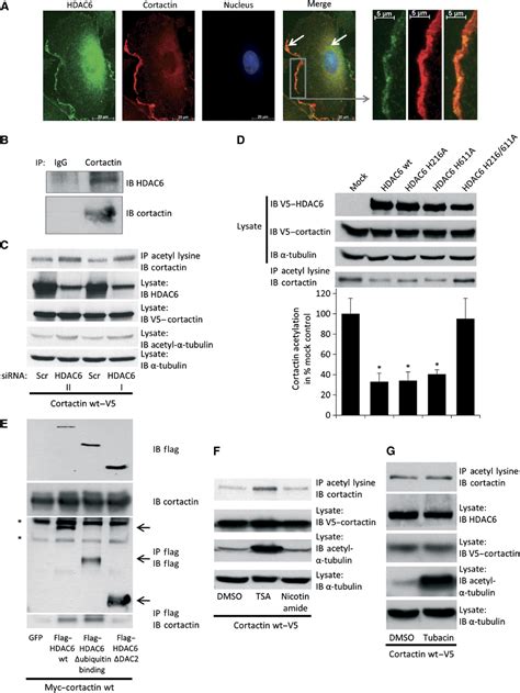 Class Iib Hdac Regulates Endothelial Cell Migration And Angiogenesis