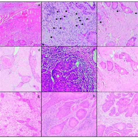 The Relationship Between The Histopathological Parameters Was Examined Download Scientific