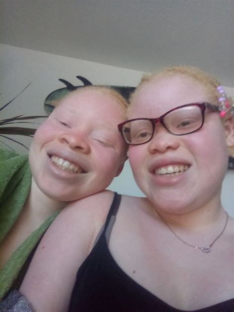 People Albino Albino Model Albinism Black Beauty Africans Women
