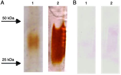 Characterization Of The Lipoarabinomannan LAM Extract A Coomassie