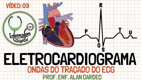 Eletrocardiograma Ondas Do Tra Ado Da Eletrocardiografia V Deo