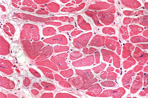 Man Cardiac Muscle Transverse Section X Man Mammals