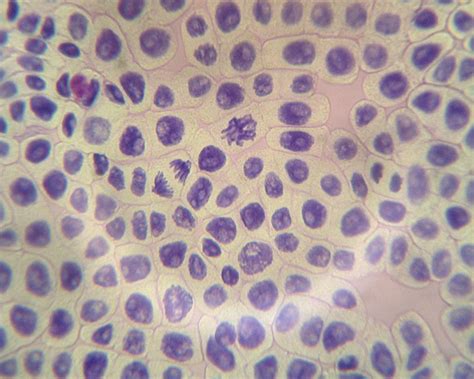 IS3000 DNA/Chromosome Staining