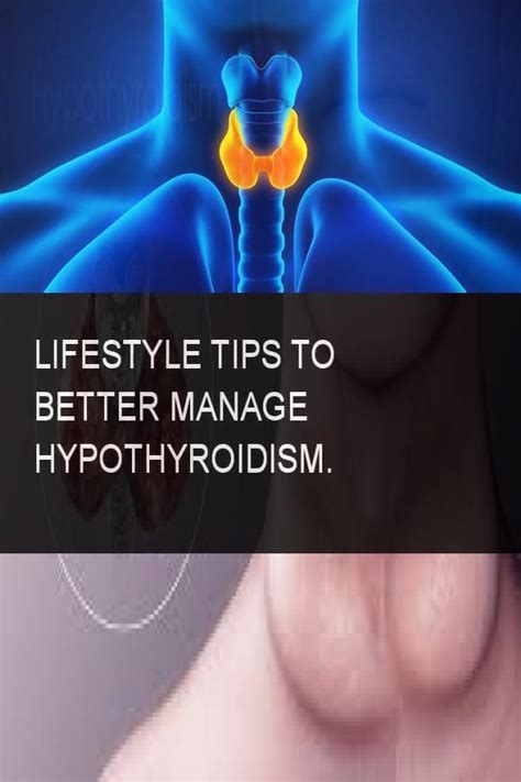 Lifestyle Tips To Better Manage Hypothyroidism Hypothyroidism