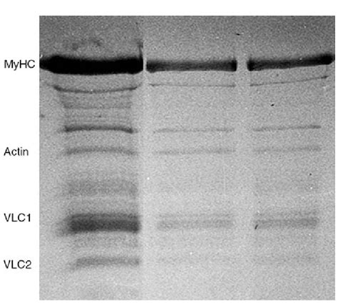 Sds Page In Gels Of Ventricular Myosin Light Chains From Muscles Of