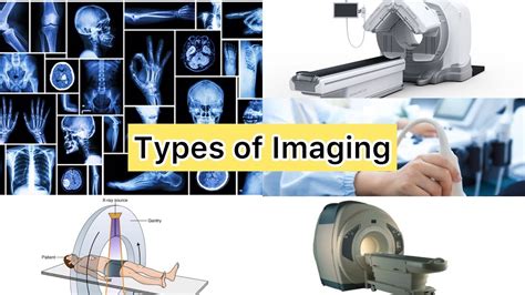 Types Of Imaging Modalities