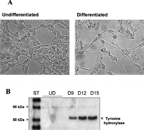 Morphological And Biochemical Characterization Of Undifferentiated And