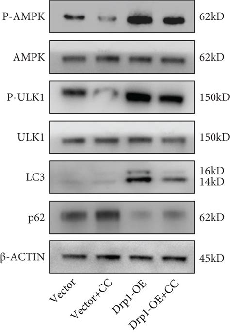 Drp1 Induced Energy Stress Enhanced Cell Protective Autophagy By